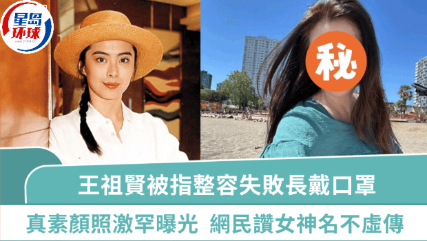 王祖贤被指整容失败长戴口罩
